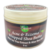 Acne & Eczema Whipped Shea Butter
