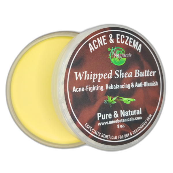 Acne & Eczema Whipped Shea Butter - Image 4