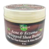 Acne & Eczema Whipped Shea Butter